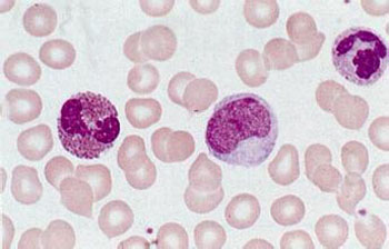 血液分析仪的白细胞计数的目的和意义