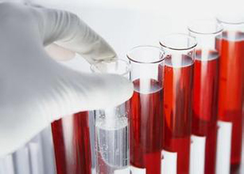 血球分析仪检测方法的改进与进展