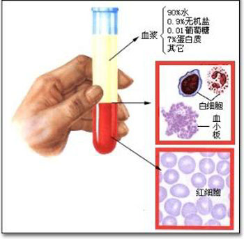 红细胞变形性异常与相关疾病