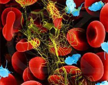 血液流变学影响血液粘度的因素