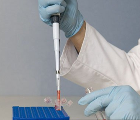 生化分析仪检测血液中的白蛋白