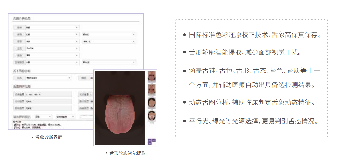 中医舌诊仪（舌象信息采集管理系统）MT-SX-02舌象分析特点.png